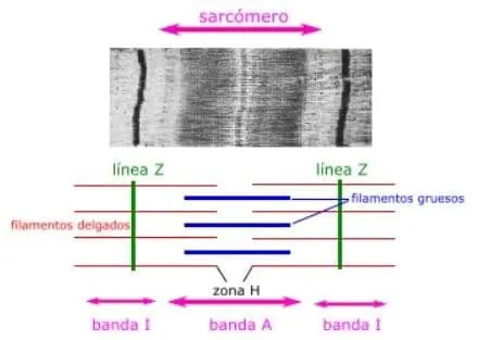 Sarcómero