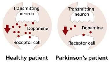 Parkinson's disease and dopamine